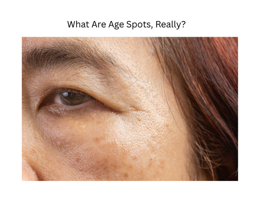 What Causes Age Spots, And 5 Proven Ways to Fade Them Naturally